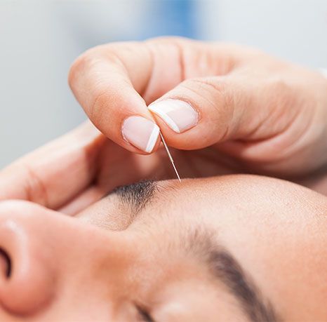 Placing needle at forehead.